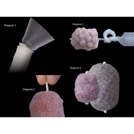 ESP PVA Mesh Kit 32mm